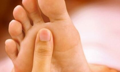 Comment être traité à partir de champignon de clous sur les jambes avec du savon domestique